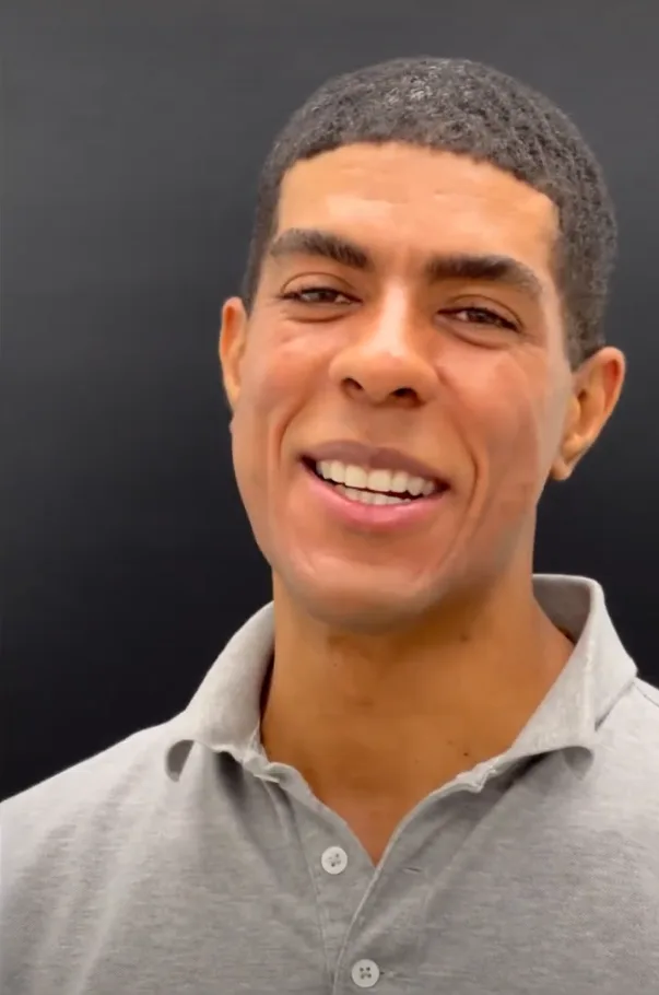 Hanna Face and Jaw Plastic Surgery NYC