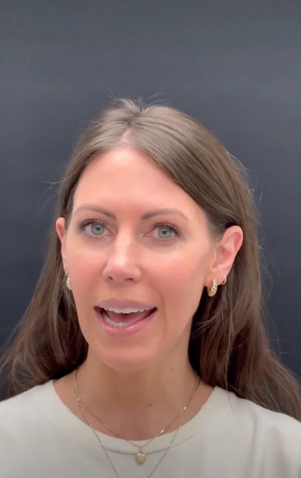 Jaw Surgery by Dr Todd Hanna NYC