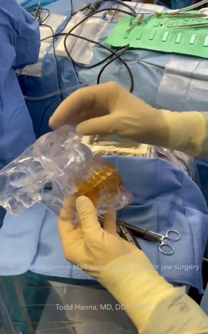 Jaw Surgery by Dr Todd Hanna