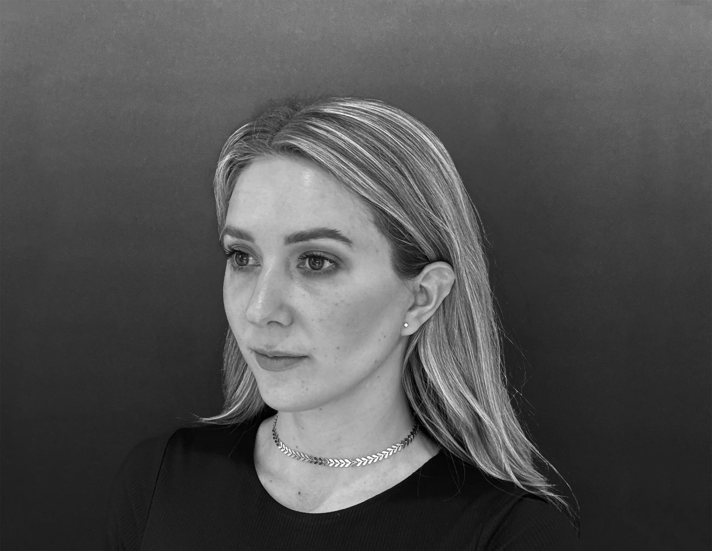 Brow Lift Todd Hanna NYC Facial Surgeon