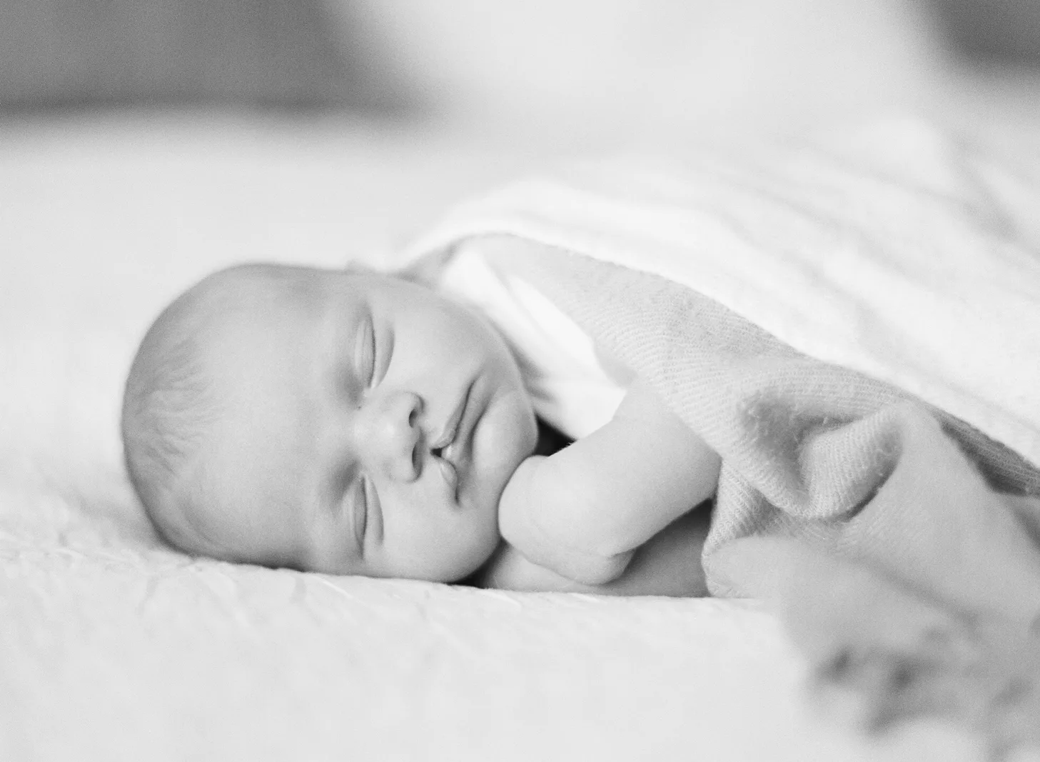 Cleft Orthognathic Surgery Todd Hanna Manhattan