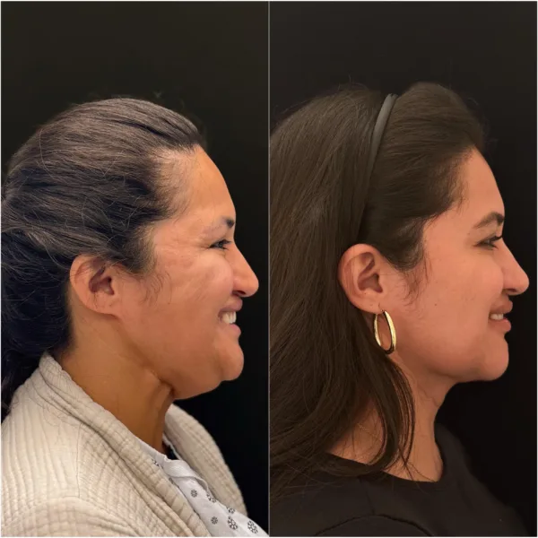 Client OO